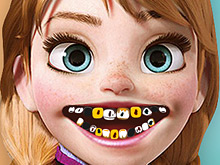 Холодное сердце: Больные зубы Анны